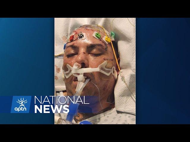 Investigation begins Prince Albert police tase and beat man during traffic stop | APTN News