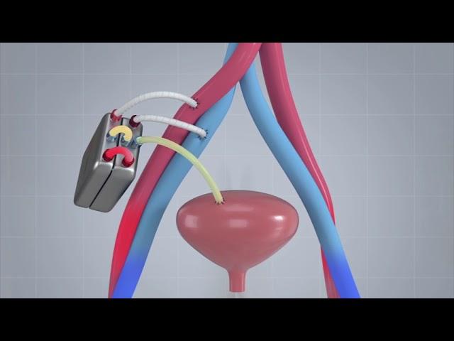 The Kidney Project successfully tests a prototype bioartificial kidney