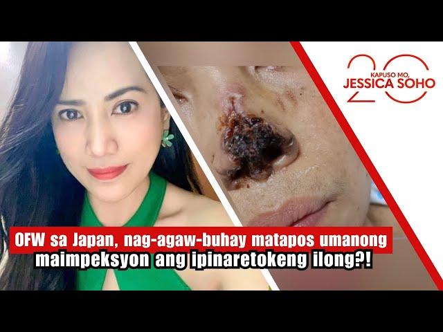 OFW fights for her life after infection from a nose surgery?! | Kapuso Mo, Jessica Soho