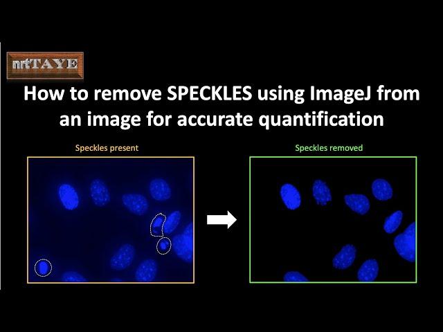 How to remove SPECKLES using ImageJ from an image for accurate quantification