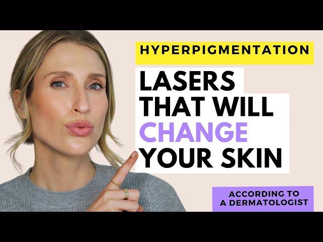 The Best Laser Treatments for Hyperpigmentation | Dr. Sam Ellis