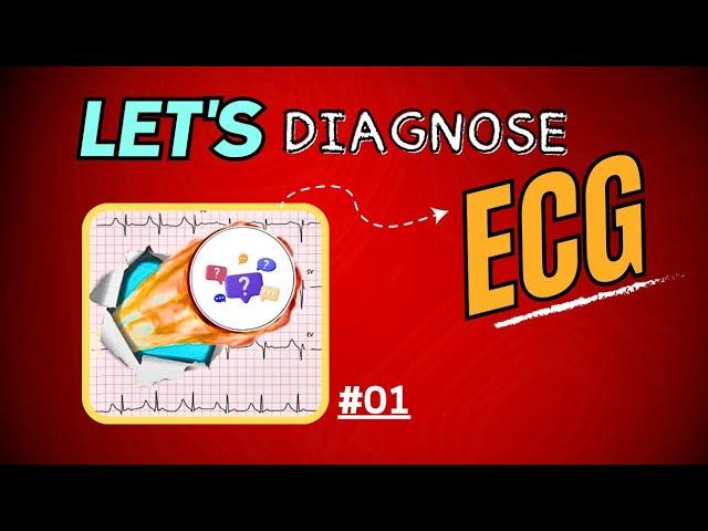 ECG Physiology | ECG Quiz 01 🩺 | LET'S DIAGNOSE ECG - Series.