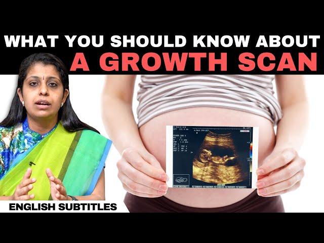 Growth Scan In Pregnancy | கரு வளர்ச்சி ஸ்கேன் பற்றி நீங்கள் தெரிந்து கொள்ள வேண்டிய விஷயங்கள்!