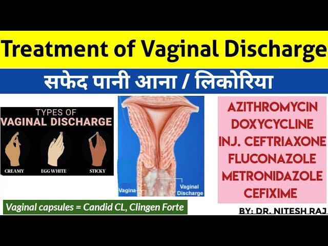 White discharge,vaginal discharge, leucorrhoea(लिकोरिआ),योनि से सफेद पानी ka इलाज ..by drniteshraj