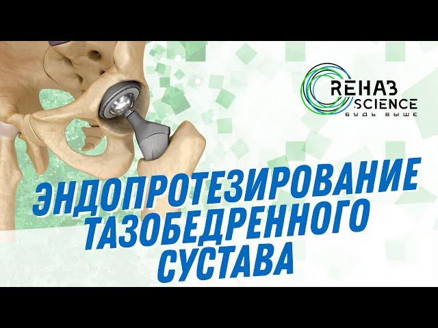 Эндопротезирование тазобедренного сустава: Протокол реабилитации