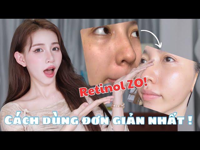 Cách dùng Retinol ZO hiểu quả, ít kích ứng cho người mới ! Mai Trinh