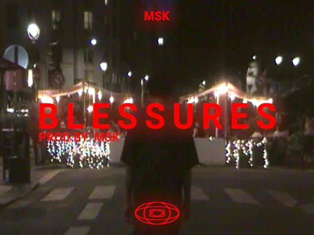 MSK - Blessures (Visualizer)