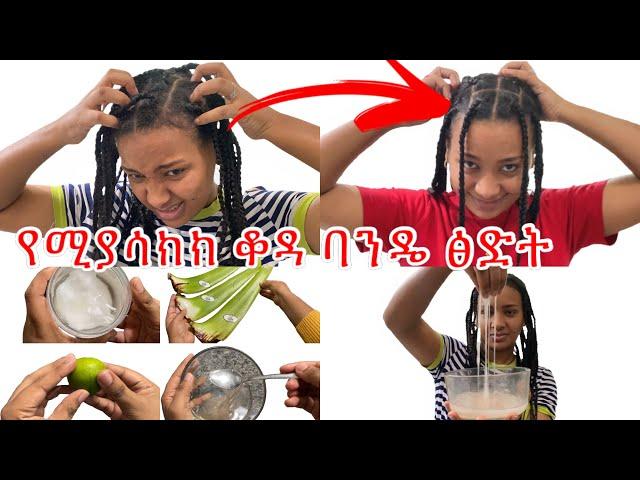 ፀጉሬን ካሳከከኝ ፎሮፎርም ካለው እንደዚ ነው ፅድት ማደርገው የማድሰው//dandruff homemade remedy