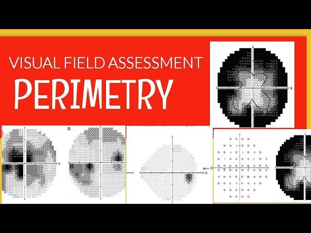 PERIMETRY|| How to read a visual field printout?