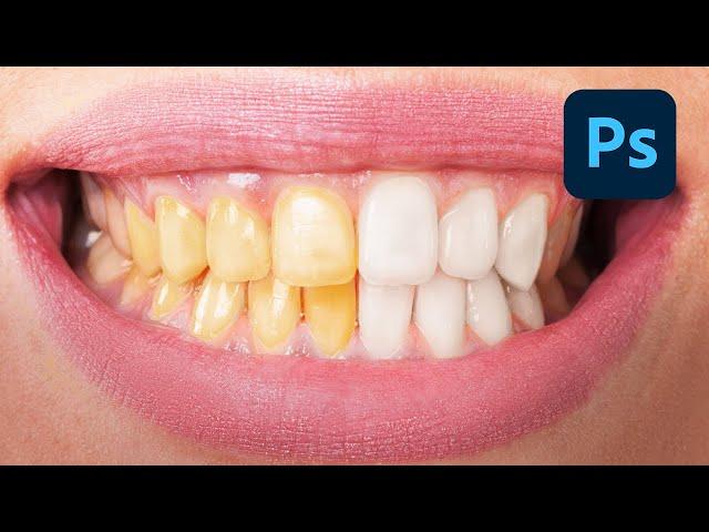 How To EASILY Whiten Teeth In Photoshop