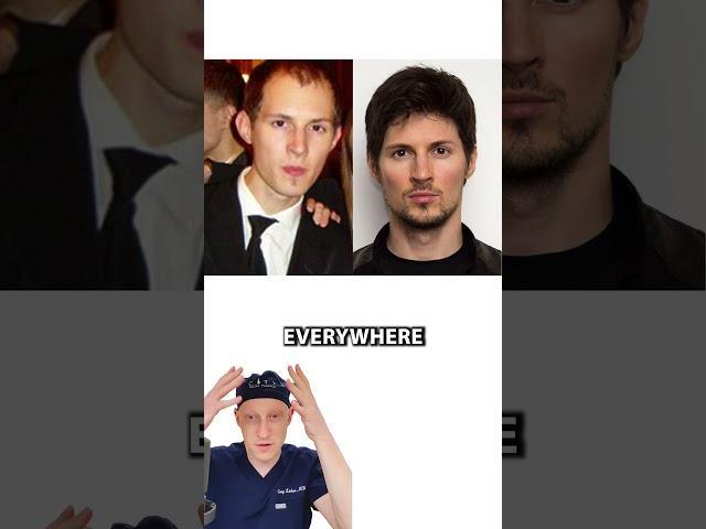 Did Pavel Durov (Telegram) Have A Hair Transplant?