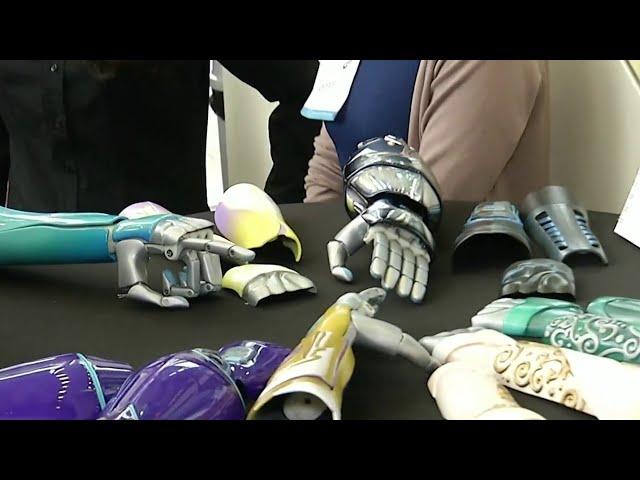 UCF launches first clinical trial of 3D-printed prosthetics for kids