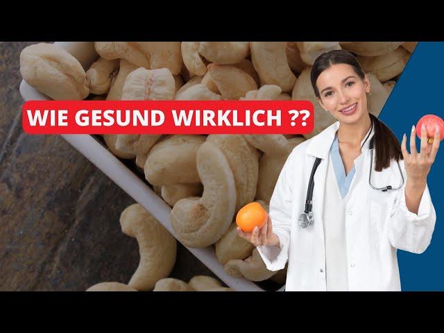 Wie gesund sind Cashewkerne wirklich? Alles über die Superfood Nuss