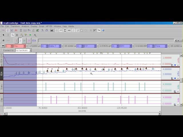 EDA - SCR Event Related Analysis | AcqKnowledge