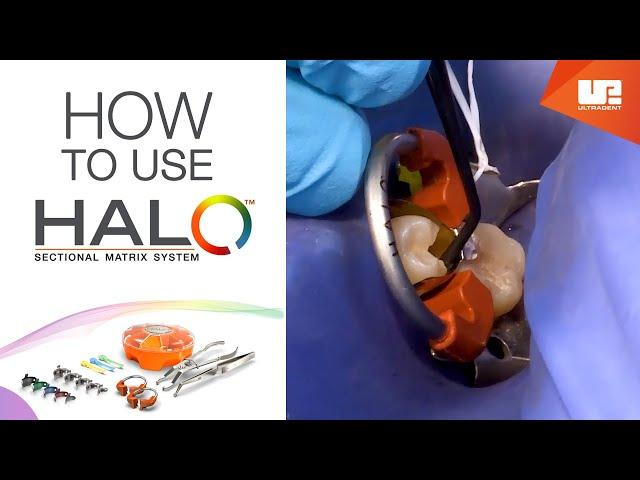 How to Use Halo™ sectional matrix system