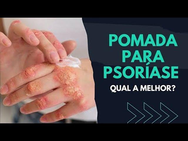 Qual MELHOR POMADA PARA PSORÍASE? [ SAIBA! ]