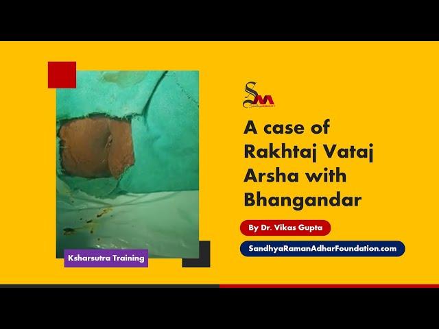 A case of Rakhtaj Vataj Arsha with Bhangandar | Dr Vikas Gupta | Sandhya Raman Adhar Foundation