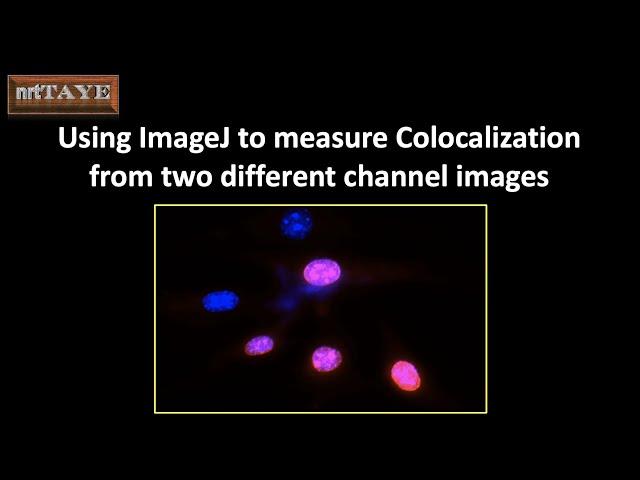 Using ImageJ to measure Colocalization from two different channel images