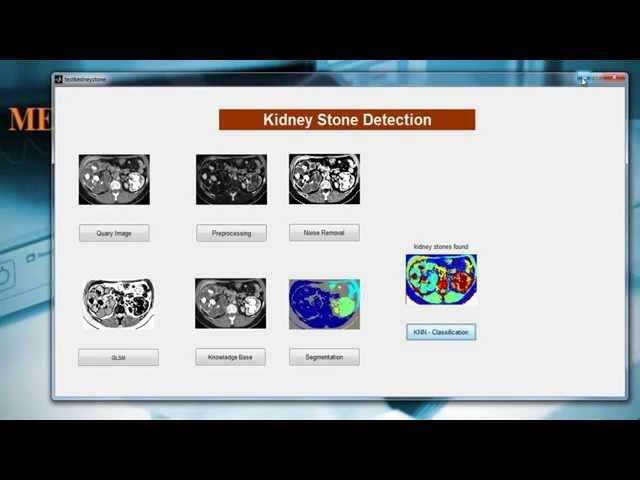 Medical Image Processing Projects | Medical Projects