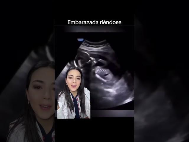 Cómo se ve un #bebe cuando #mama #embarazada se ríe #feto 🫨