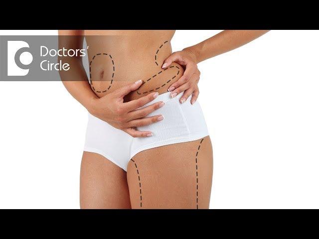 Which body areas can be treated by Liposuction? - Dr. Pavithra H N