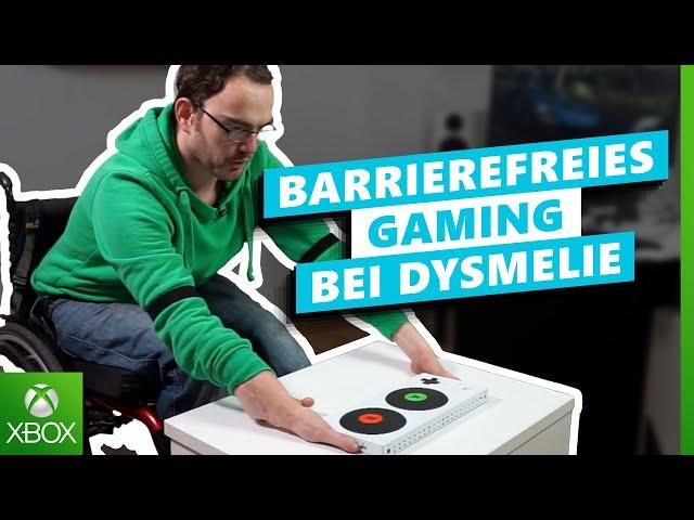 Tipps zum Gaming Set-Up bei Dysmelie