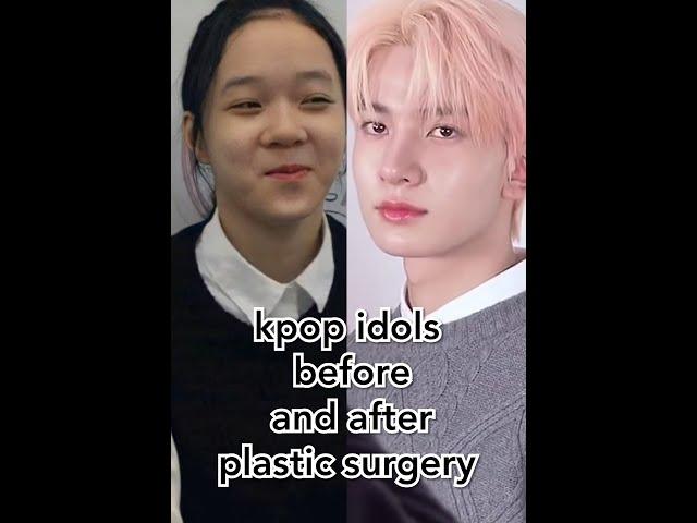 kpop idols before and after plastic surgery [ part 1 ]#shorts #enhypen #itzy #ive #aespa #kpopedit