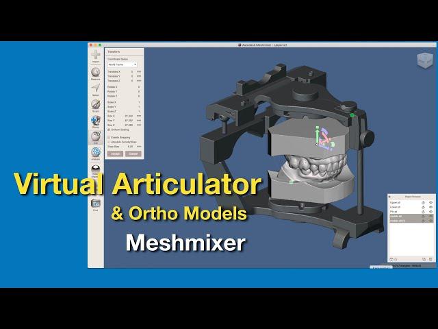 Virtual Articulator and ortho casts