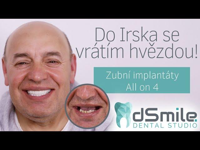 Jak probíhá implantace zubů během 1 dne?