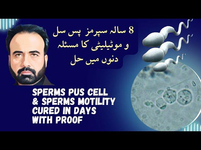 Pus cell in Semen &  Sperm Motility  Cured With   Al saif homeo regime  in Days |Urdu , Hindi |