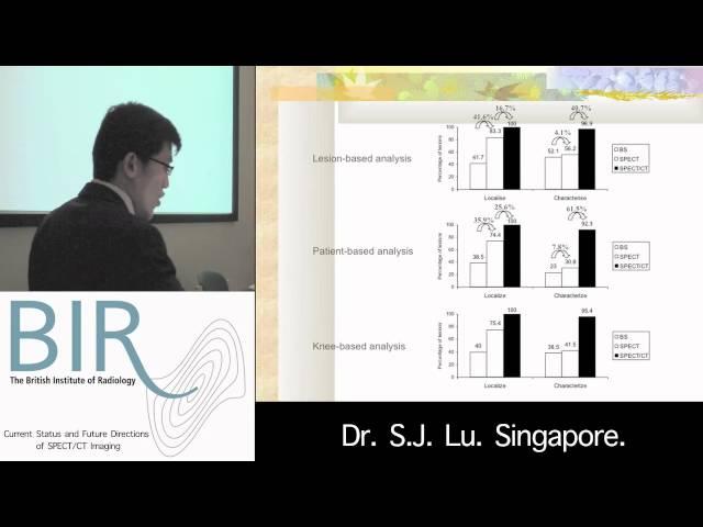 Current Status and Future Directions of SPECT/CT Imaging:  SPECT/CT in patients with knee pain