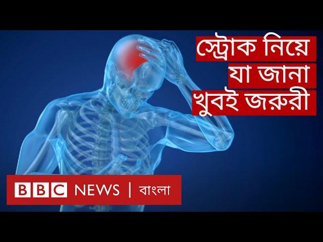 Stroke: স্ট্রোকের কারণ, লক্ষণ ও ঝুঁকি এড়ানোর উপায় | BBC Bangla