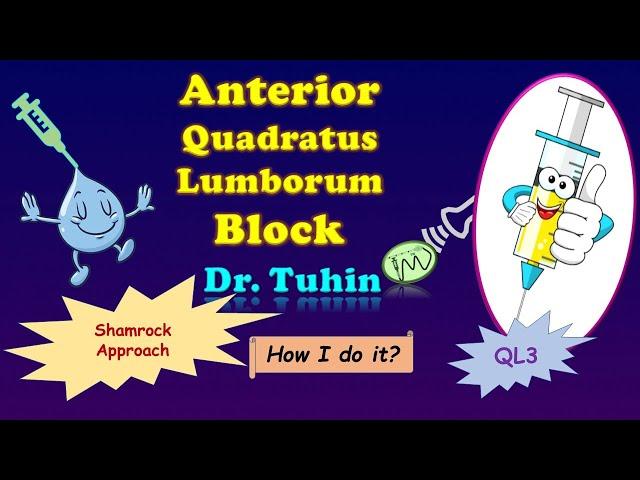 Quadratus Lumborum (QL) Block : Anterior approach | Transmuscular QLB | Type 3 QL Block| Ultrasound