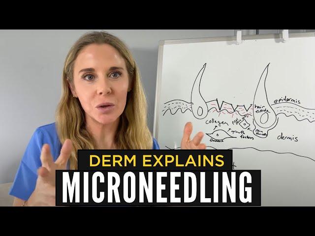 Best Way To Microneedle At Home Explained By A Dermatologist