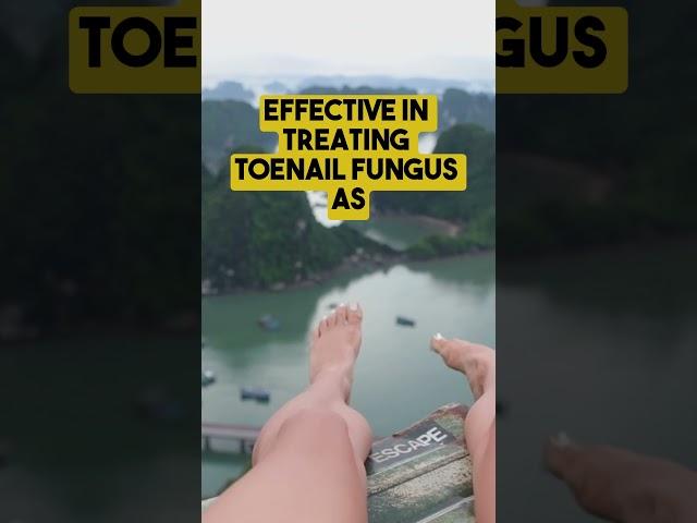 3 Easy Home Remedies for Toenail Fungus