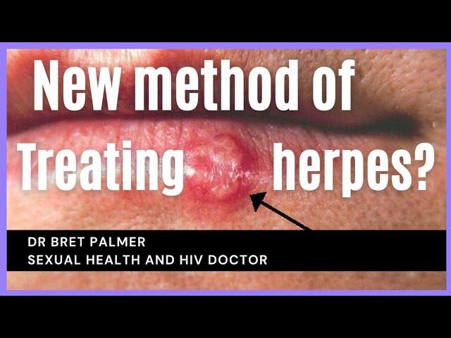 Possible new treatment for herpes?