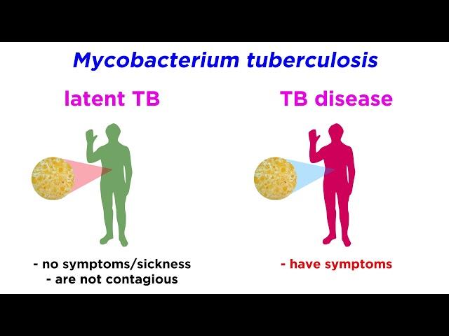 Multidrug-Resistant Tuberculosis (MDR-TB): Mycobacterium tuberculosis