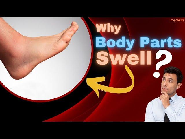 Why Body Parts Swell?