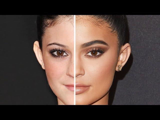 KYLIE JENNER: Before and After Plastic Surgery