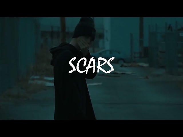 (Free) NF Type Beat - Scars