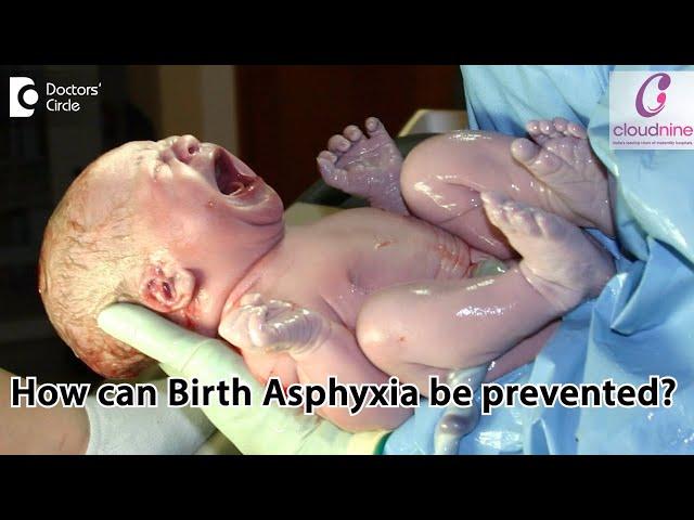 How can Birth Asphyxia be prevented? - Dr. Piyush Shah of Cloudnine Hospitals | Doctors’ Circle