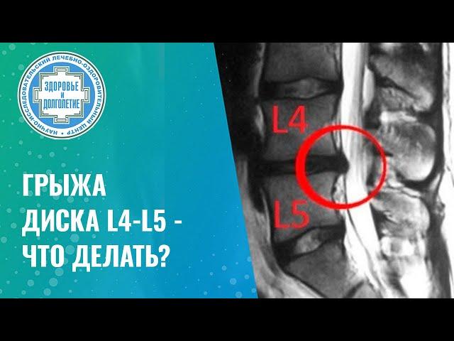 ⭕  Грыжа диска L4-L5 - что делать?