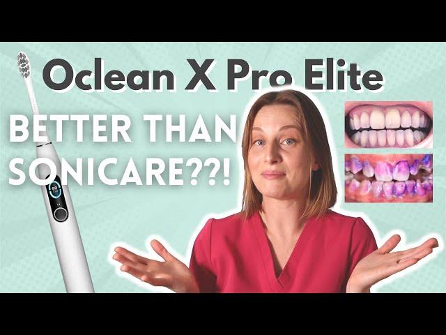 Sonicare SenseIQ VS Oclean X-Pro Elite | Electric Toothbrush Review