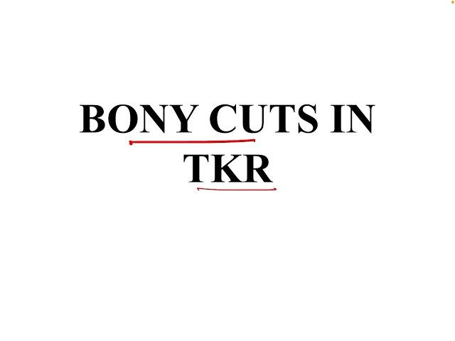 Bony cuts in Total Knee Replacement