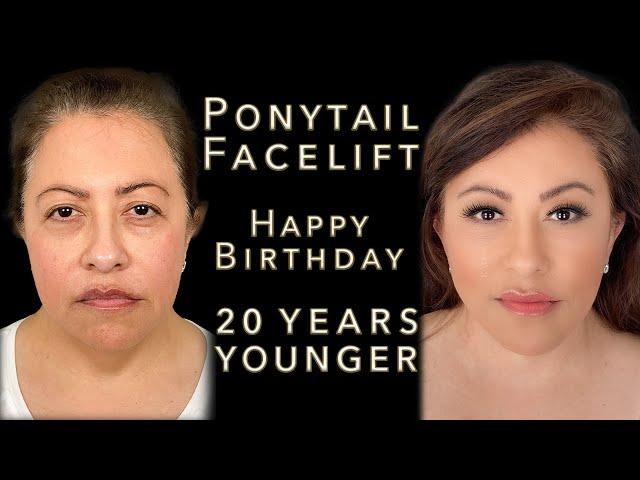 She Got Ponytail Facelift For Her Birthday! - KaoEyes, Jowl Lift, Neck Lift - Amazing Birthday Gift!