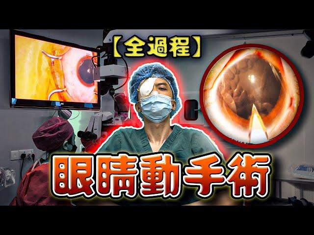 【手术全过程】人生中第一次眼睛动手术！近视手术的真实体验?!?!