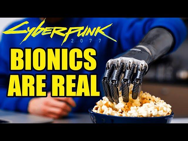 Real bionic tech is making 2024 look like Cyberpunk 2077