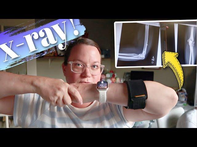 GETTING X-RAYS ON MY ELBOW TO SEE WHAT'S WRONG WITH IT | ELBOW X-RAYS | ELBOW PAIN DIAGNOSIS