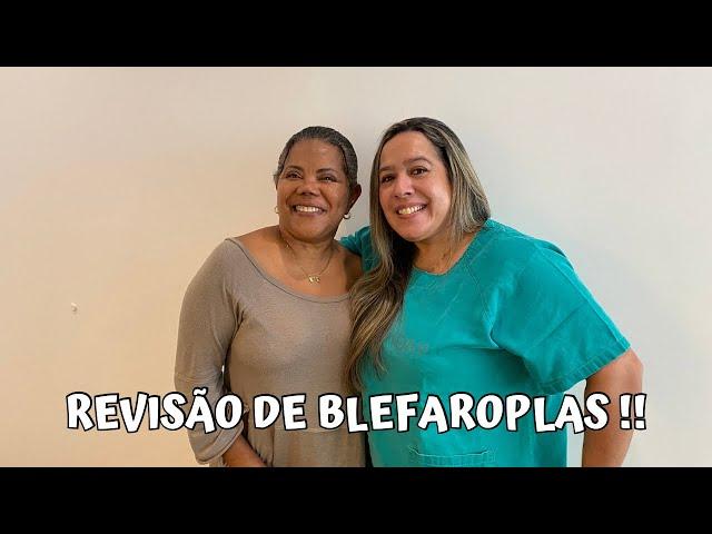 Vocês não vão acreditar com o que a médica receitou para eu fazer massagem nos olhos!