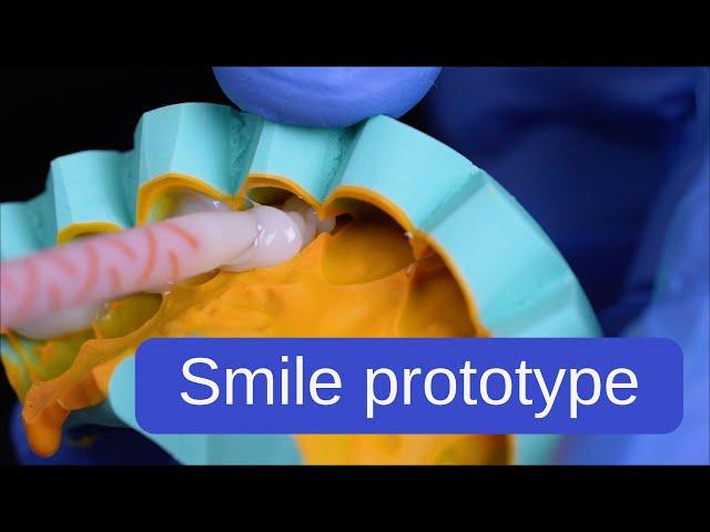 Mock-up: tips and tricks for a successful smile prototype